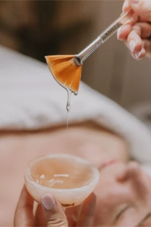 Tratamiento Peeling con ácidos