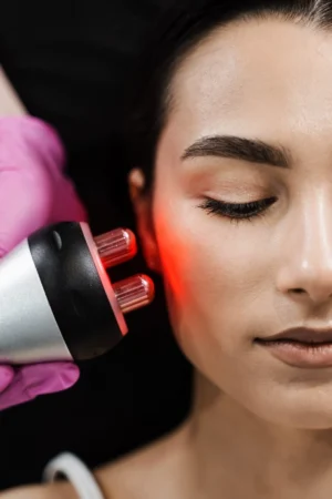 Tratamiento con Radiofrecuencia